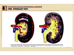 Рельефная таблица "Почка. Фронтальный разрез" (формат А1, матовое ламинирование) - fgospostavki.ru - Ростов-на-Дону
