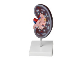 Модель почки в разрезе - fgospostavki.ru - Ростов-на-Дону