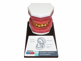 Демонстрационная модель "Ротовая полость курильщика" - fgospostavki.ru - Ростов-на-Дону